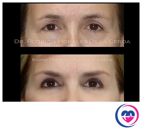 Serivce Image